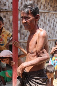 Bij Amir Hussein werd twee jaar geleden zijn arm gebroken door een boeddhistische menigte. Omdat er geen dokter beschikbaar was om de botbreuk te behandelen bungelt zijn linkerarm nu grotesk en nutteloos in een vreemde hoek langs zijn lichaam.